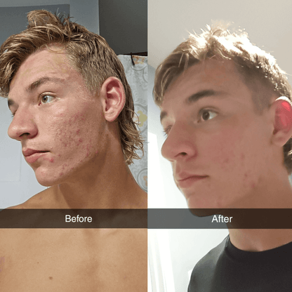 Shield Face Wash