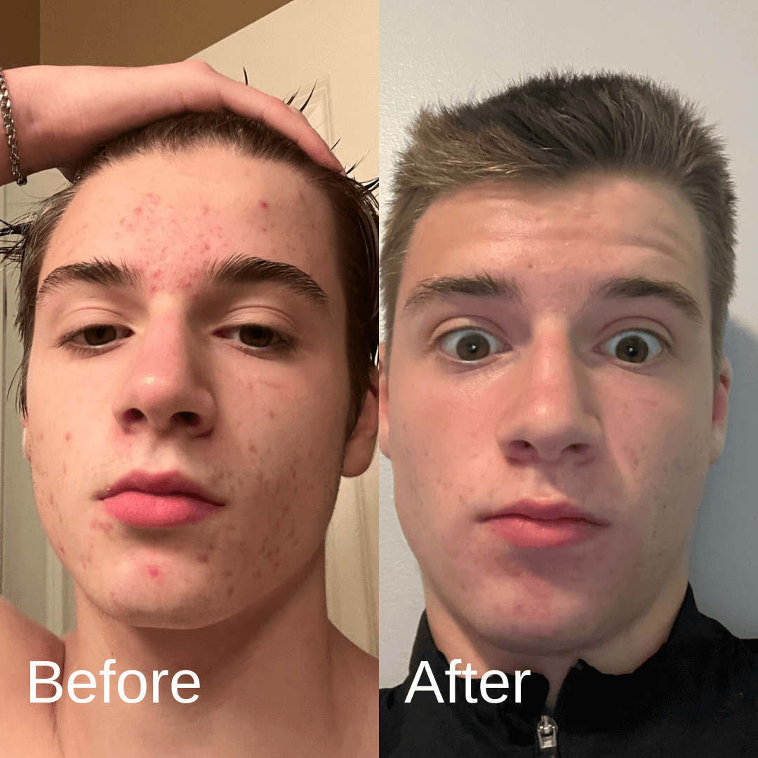 Shield Face Wash